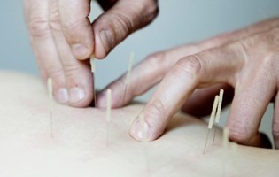Akupunktur i praksis